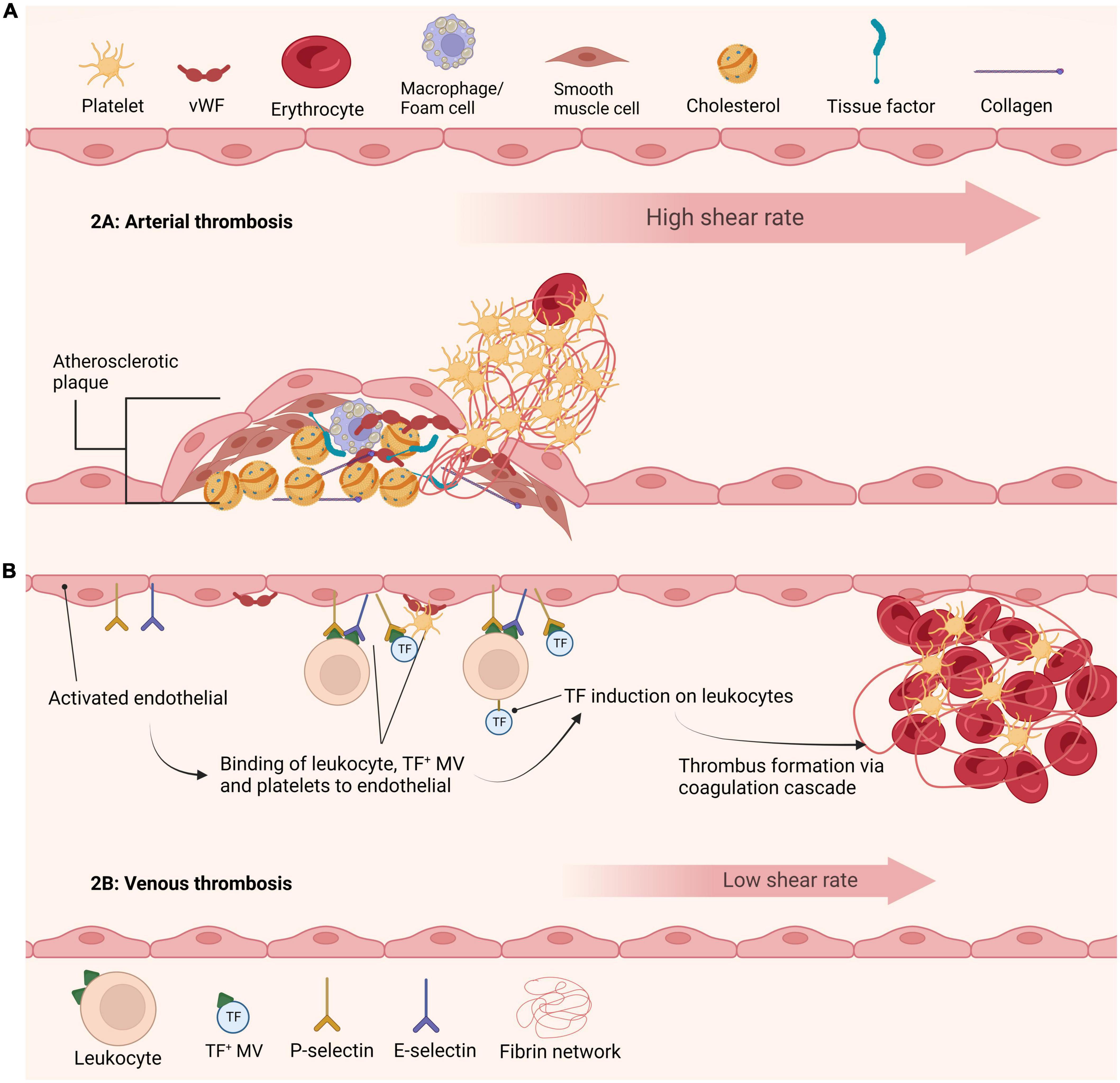 Location, location, location: Fibrin, cells, and fibrinolytic factors in thrombi
